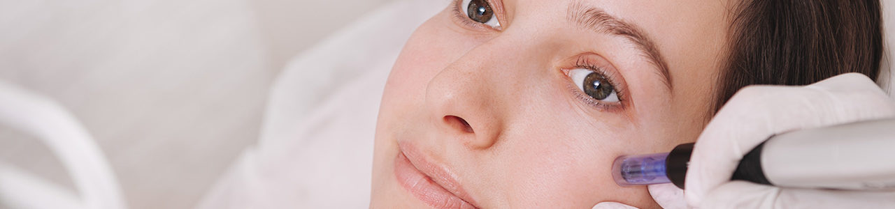 Microneedling