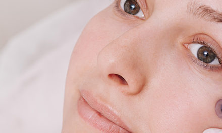 Microneedling