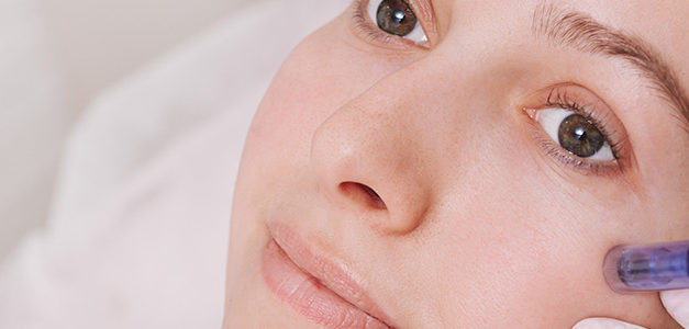 Microneedling